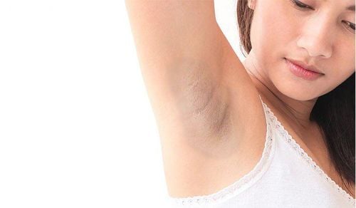 Is there any way to treat dark underarms?