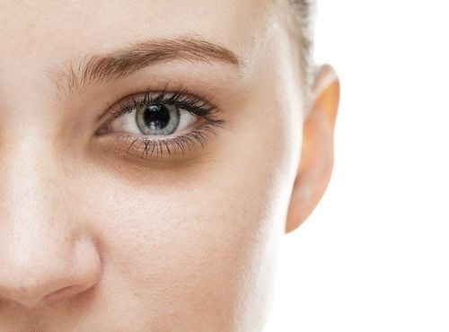 Causes of dark circles under eyes