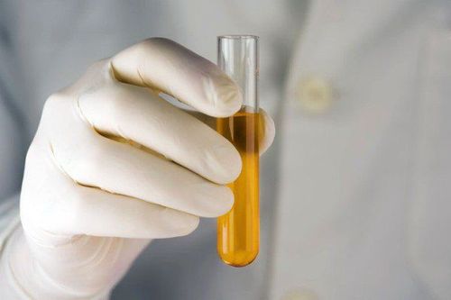 Cloudy urine is a sign of what disease?