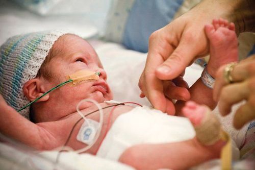 Create a bond and take care of a premature baby in a special treatment area