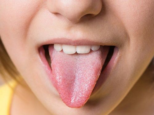 Lưỡi nói gì về sức khỏe của bạn?