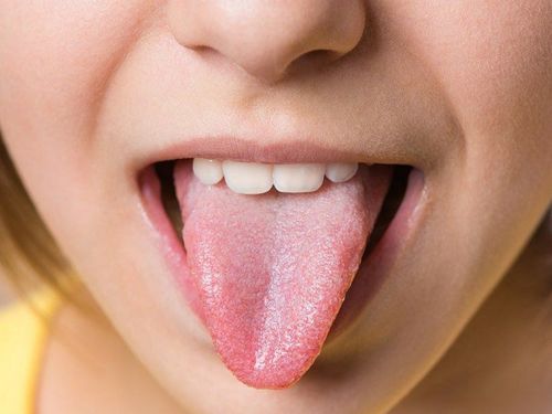 What does your tongue say about your health?