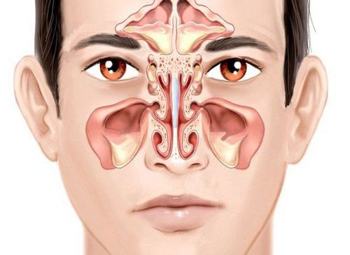 Why does sinusitis cause loss of smell?