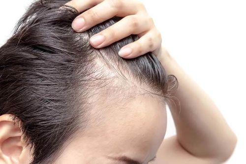 Dead hair follicles: What can you do at home?