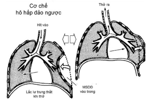 
Hô hấp đảo ngược được mô phỏng qua ảnh minh họa
