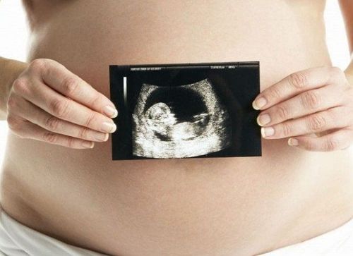 Các nguyên nhân độ mờ da gáy cao được chẩn đoán xác định bởi bác sĩ chuyên khoa