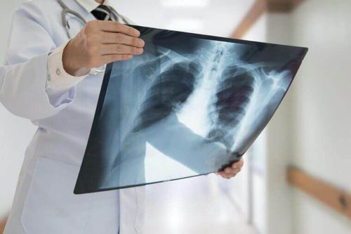 Có thể chụp X quang phổi khi mang thai 9 tuần không?