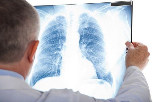 Is pleural tuberculosis contagious?