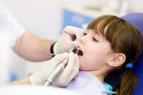 Trẻ trám răng có nên gây mê không?