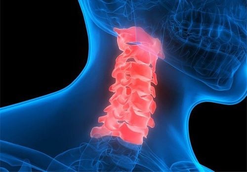 Treatment of acute cervical spinal cord injury