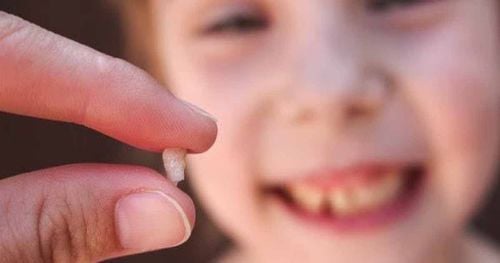 Can a 5 year old child have a tooth extracted?