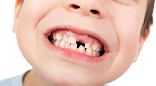 Baby teeth take a long time to grow back, do you need to go to the doctor?