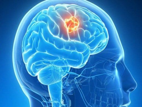 Brain Tumors: Overview and Basic Concepts