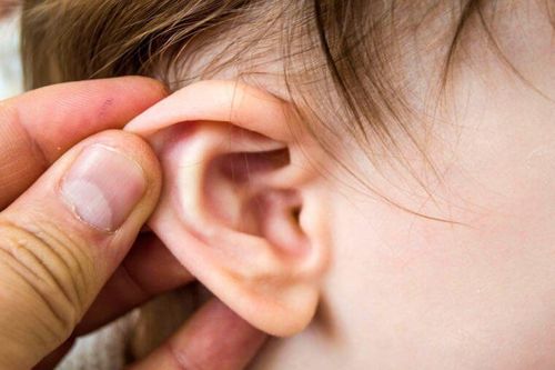 Trẻ bị viêm tai giữa mưng mủ cấp có nguy hiểm không?