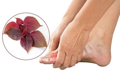 Perilla leaves can cure gout?