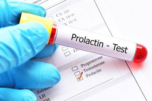 Xét nghiệm prolactin 428.34 mIU/ ml có nghĩa gì?