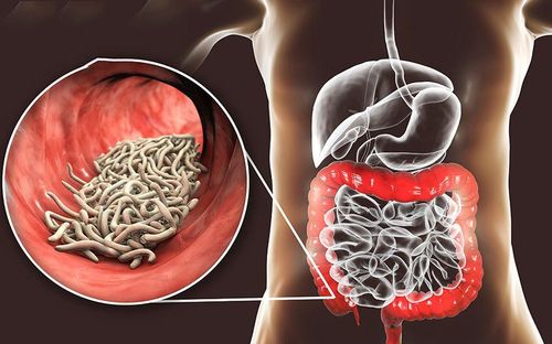 Tại sao người bị kiết lỵ đi ngoài ra máu?