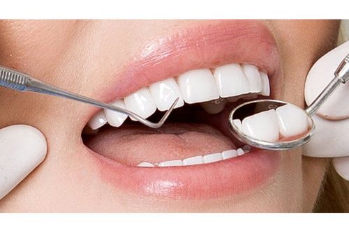 Hướng dẫn cách chăm sóc răng sứ