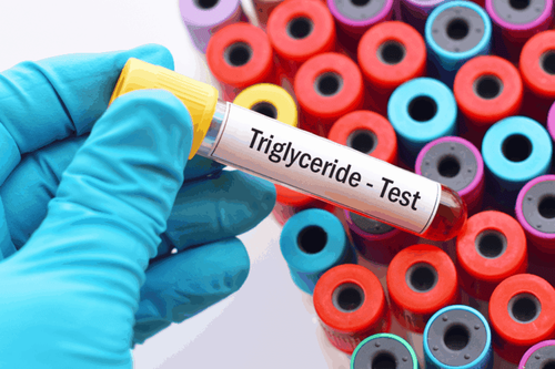Chỉ số Triglyceride cao và nguy cơ đột quỵ