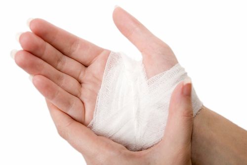Cách sơ cứu vết thương ở lòng bàn tay