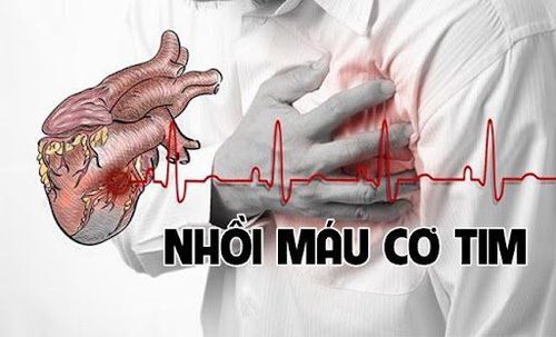 Các bước xử trí cơn đau ngực do nhồi máu cơ tim cấp khi ở một mình