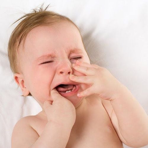 Rối loạn phát triển răng ở trẻ em