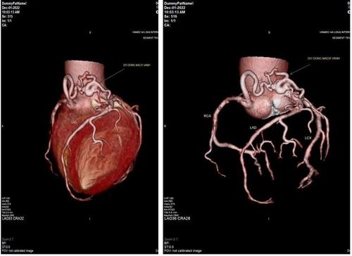 Chụp cắt lớp điện toán đa lát cắt (MSCT) – kĩ thuật chẩn đoán các bất thường tim mạch hiệu quả