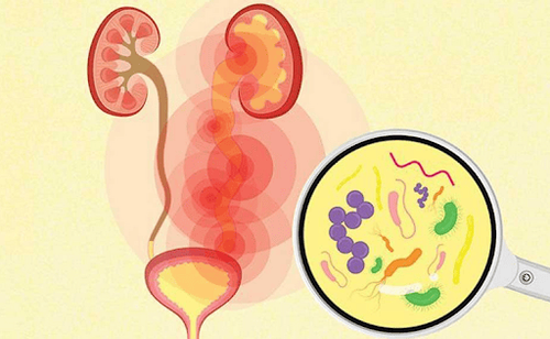 Triệu chứng cảnh báo và cách điều trị bệnh tiết niệu