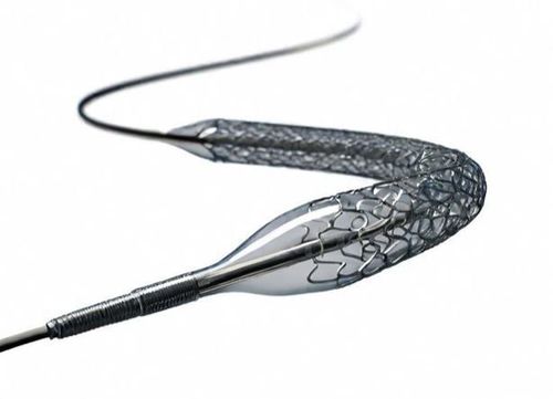 
Stent phủ thuốc là một phát minh đột phá trong điều trị bệnh lý động mạch
