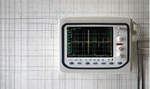 
ECG rung nhĩ là phương pháp điện tâm đồ rung nhĩ dùng để chẩn đoán bệnh
