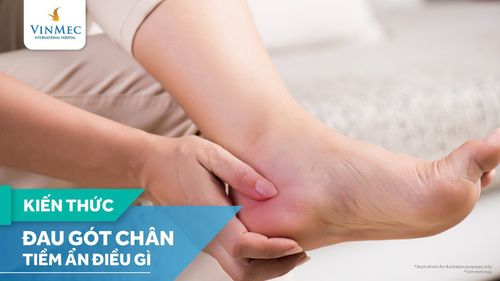 Đau gót chân là biểu hiện bệnh gì? Phải làm sao?