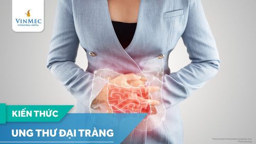 Ung thư đại tràng: Những điều cần biết