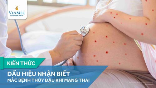 Bị thủy đậu khi mang thai 3 tháng đầu nguy hiểm thế nào?