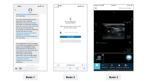  Vinmec Healthcare System digitizes medical film, stops printing hard film to save the environment