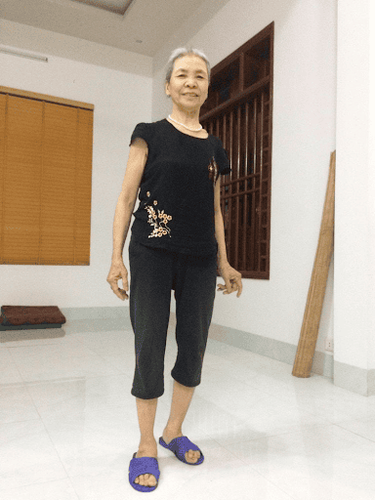 Mrs. Xuân is now incredibly happy because she can walk comfortably and easily.