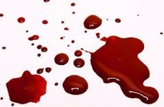 What is blood viscosity? The significance of measuring blood viscosity