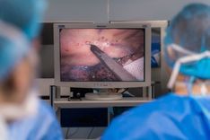 Vinmec experts and doctors demonstrated the technique of laparoscopic esophagectomy using robotic surgery technology within the framework of the conference.