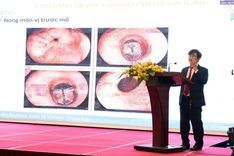 Vinmec Hosts Conference on "Advances in Laparoscopic Surgery for Esophageal Cancer Treatment"